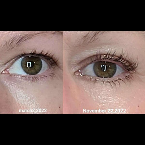 Before After RevivLash